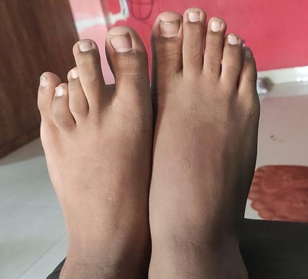 pair ki ungali