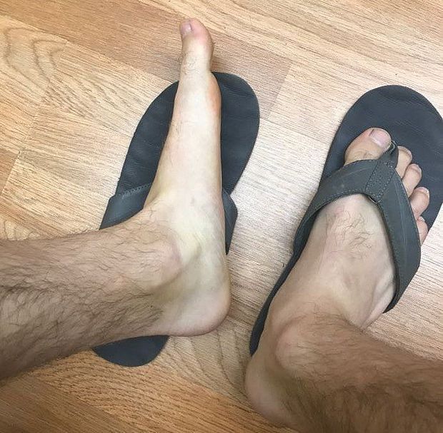 flat leg
