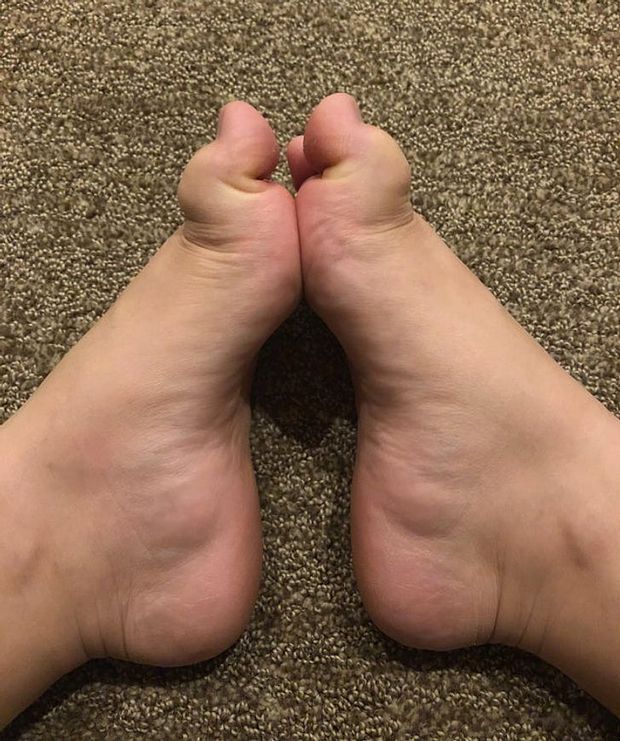 Leg thumb