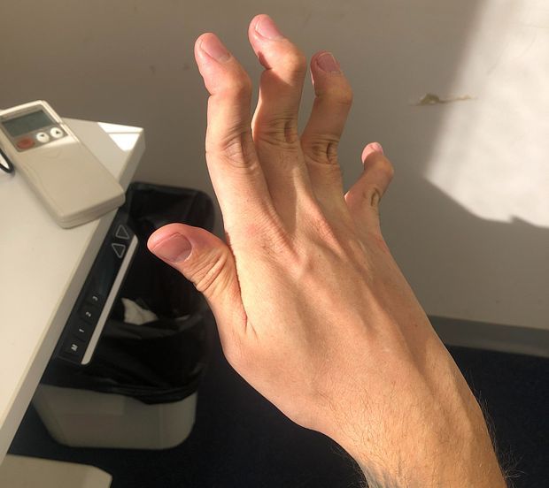 Finger bend