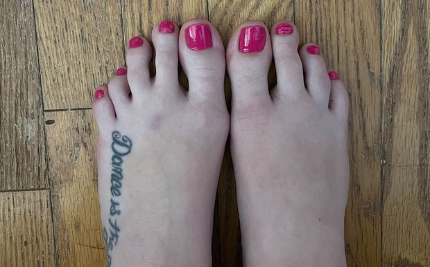 4 toes on one foot